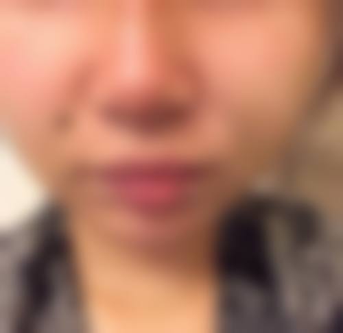 四、江苏曼雅德整形医院特色项目