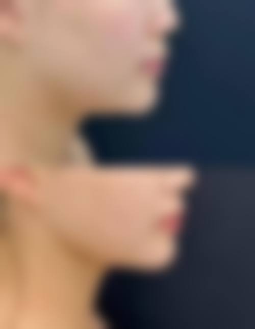 三、合肥小美微针整形医院医生介绍