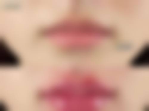 六、韩国利本韩整形美容中 心口碑如何？