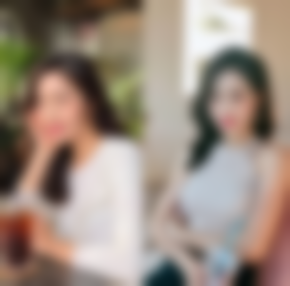 杭州悦可医疗美容诊所灵韵双眼皮术的术后护理