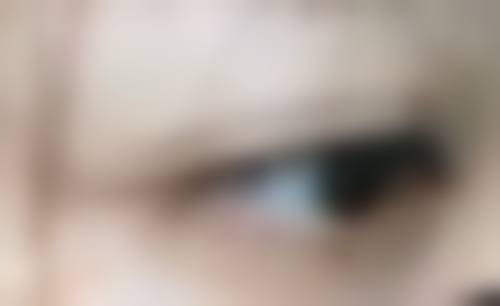 正确处理眼袋的建议