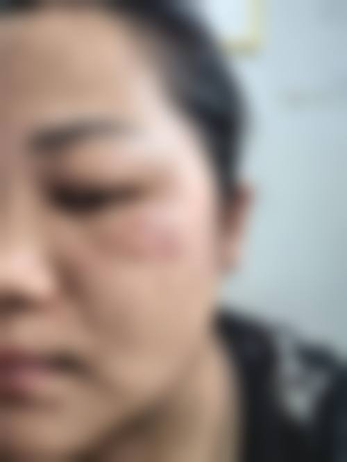 四、合肥新地医疗美容特色项目