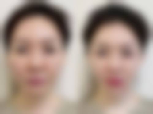 八、鸡西王医生整形外科门诊部怎么预约？