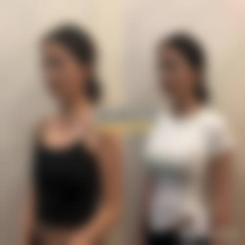 六、西安瑞丽整形医院口碑如何？