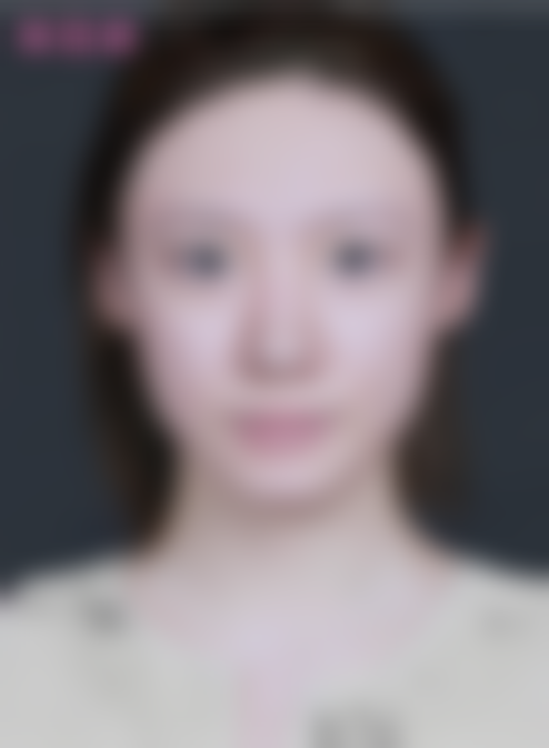 北京米兰柏羽丽都医疗美容医院自带滤镜肤色美白富勒烯述白3mL 719元起，社群专享赠检测还能随时退 