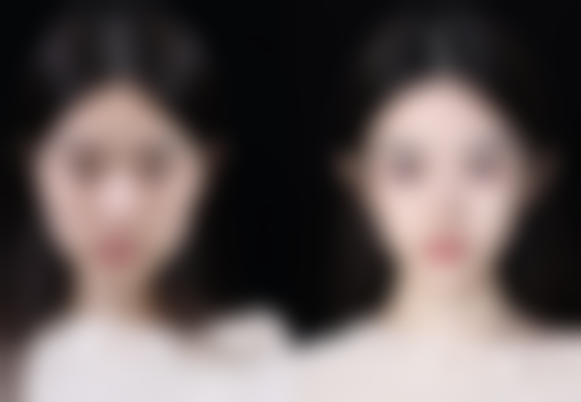 牙膏去眼袋的危害大揭秘