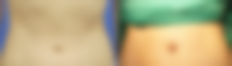 五、冯隽医生技术怎么样？