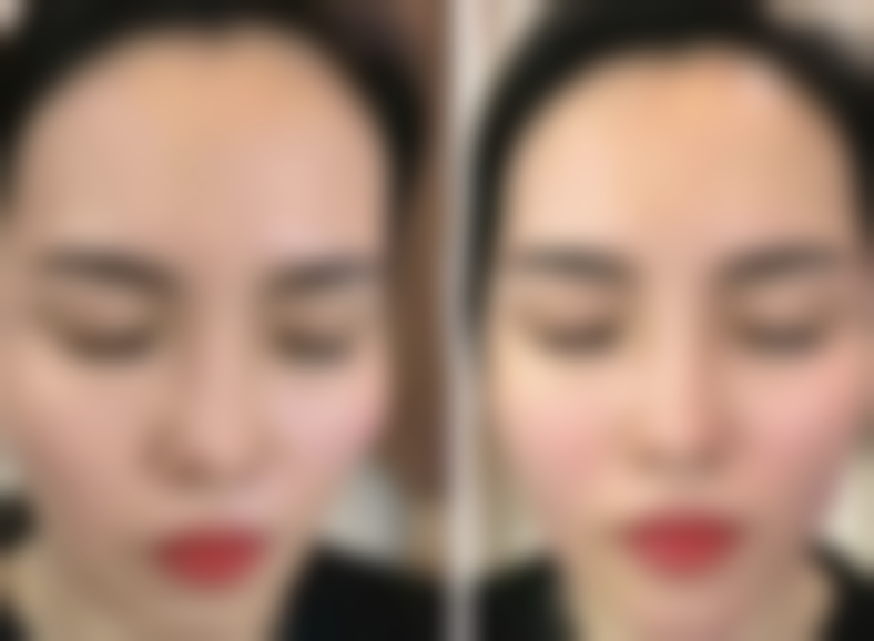 天然食材小妙招，安心去除眼袋