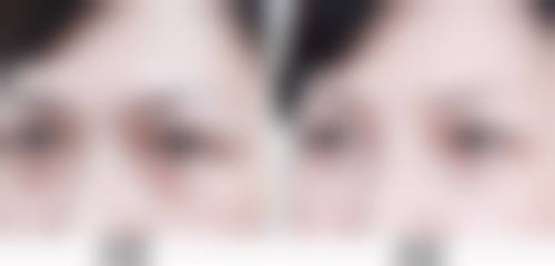 四、南宁密斯整形美容诊所特色项目