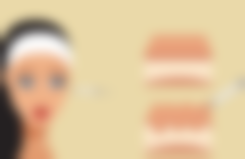 内吸去眼袋的基本修复时间