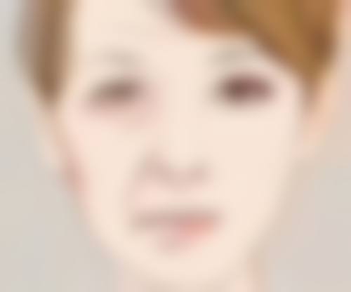 内吸去眼袋恢复期多久？一般1 - 2周基本恢复，完全恢复可能需1 - 3个月！ 