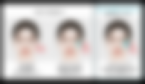 影响种植头发后续生长的毛囊供区因素