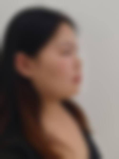 五、韩国iFace整形外科 