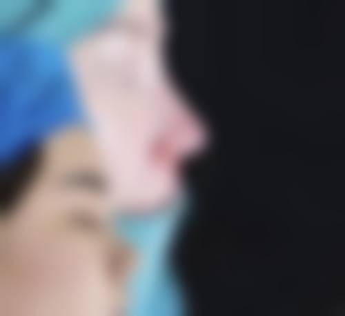 六、深圳铂雅医疗美容口碑如何？