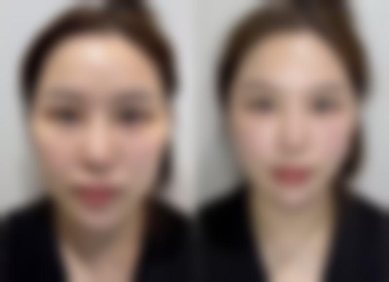 四、韩国iFace整形外科 