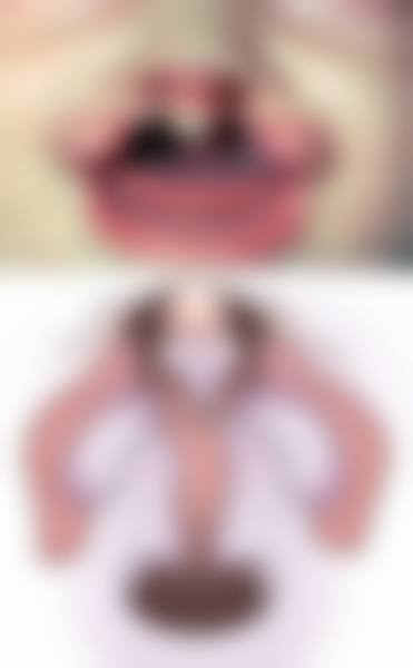 激光治疗点痣后疤痕增生