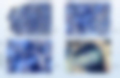 全身抽脂手术时间要多久？受抽脂范围、技术及患者状况影响，一般1 - 5小时不等！ 