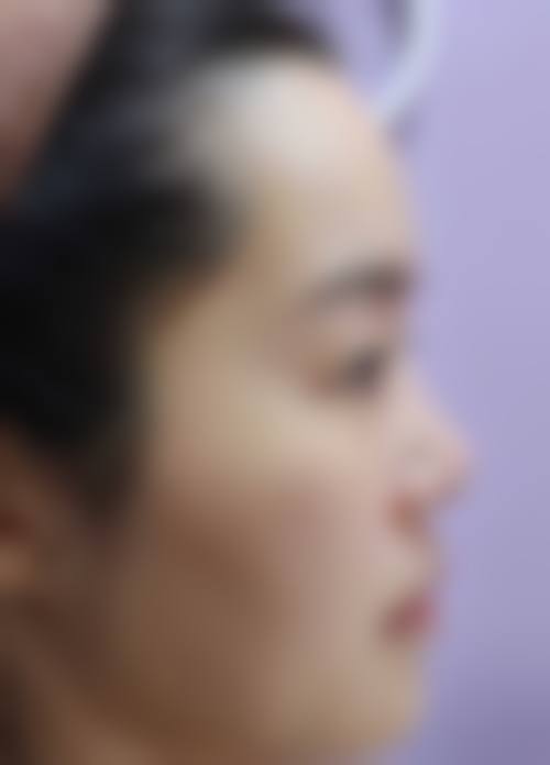 四、吉林市铭医整形美容医院特色项目