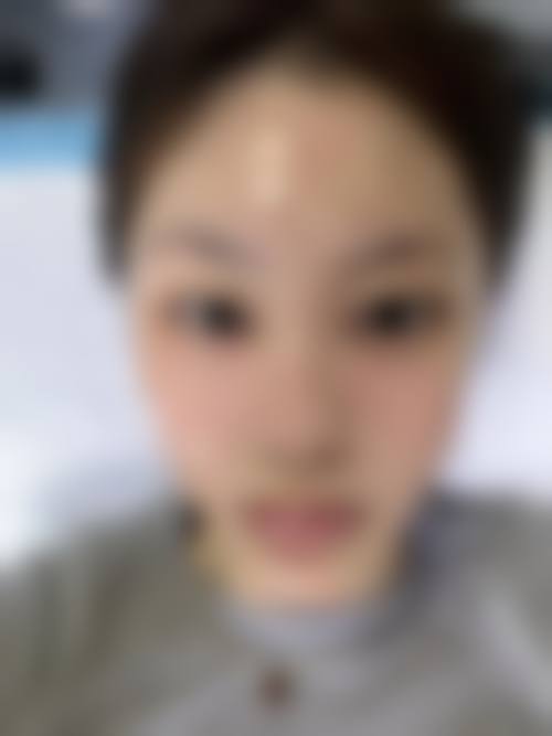 五、泰州巴宝莉整形医院收费价格表