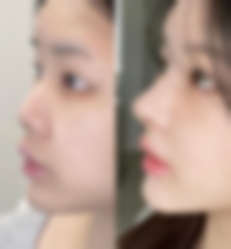 六、广州铂医昂方吴学军 医生口碑评价及真人实例反馈