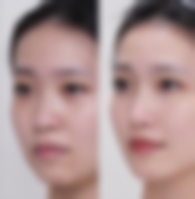 八、贵阳伊莲缇整形医院怎么预约?