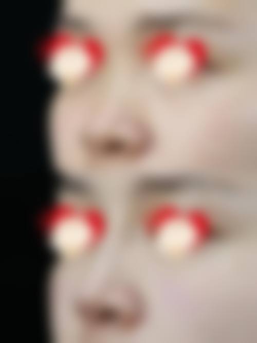 五、泉州嘉美整形医院收费价格表