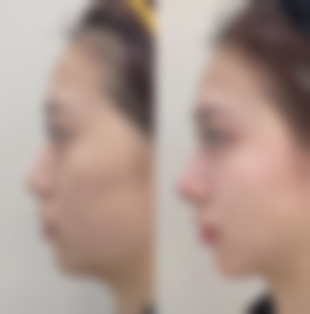 八、天津紫宸星菲医疗美容门诊部怎么预约？