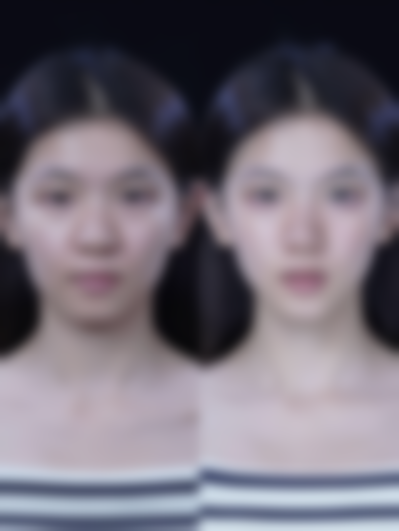 综合治疗与长期维护