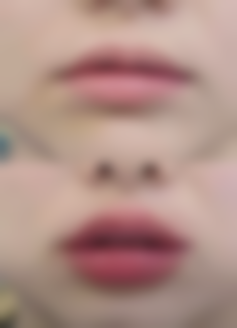 如何去除眼袋黑眼圈？从一般治疗到手术治疗，多种方法为您详细揭秘，助您重焕眼周光彩！ 