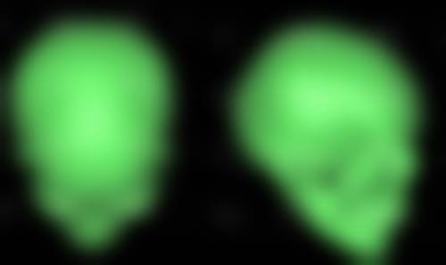 全切双眼皮太宽太深能修复吗？答案是肯定的，修复方法及注意事项一文为您说清！ 