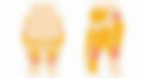 隆胸方法的选择依据