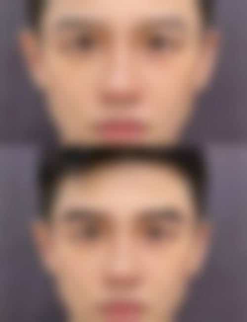 四、无锡美连堂医疗美容诊所特色项目