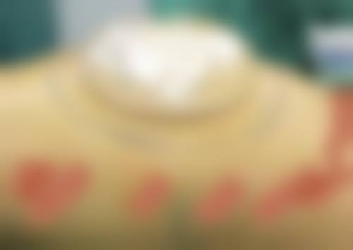 六、大连擎艺美医疗美容诊所口碑如何？