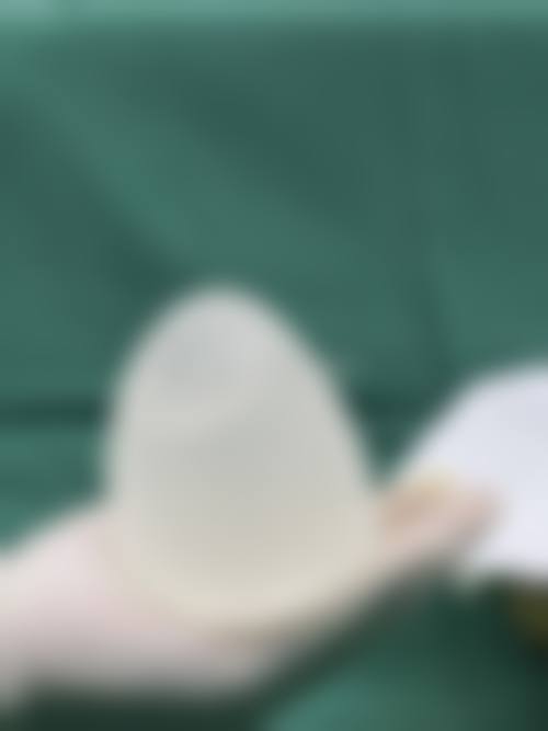 四、原辰整形外科特色项目