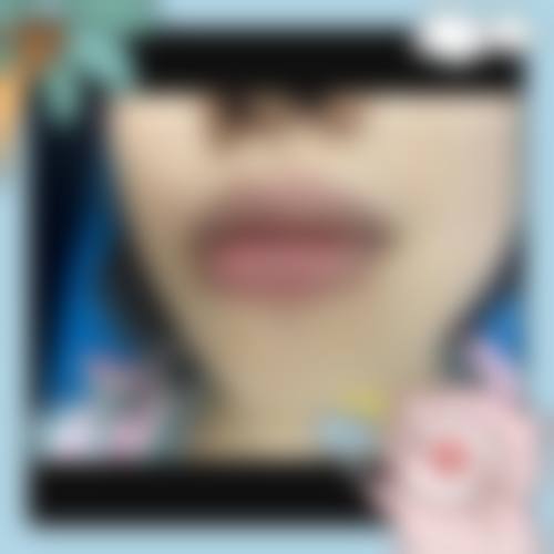 六、无锡美连堂医疗美容诊所口碑如何？