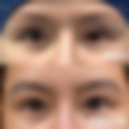 四、长沙颜华医疗美容门诊部特色项目