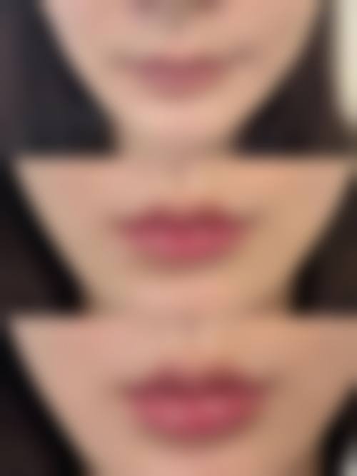 五、邢台市伊美医疗美容诊所收费价格表