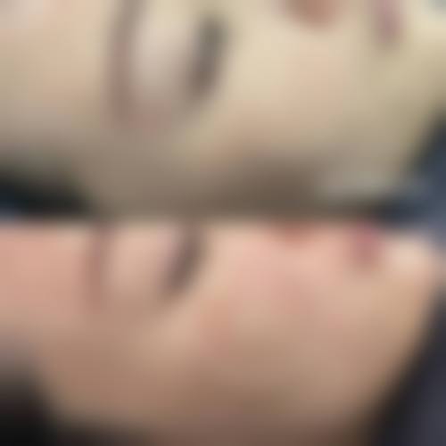 四、新宿站前宇和岛皮肤科特色项目