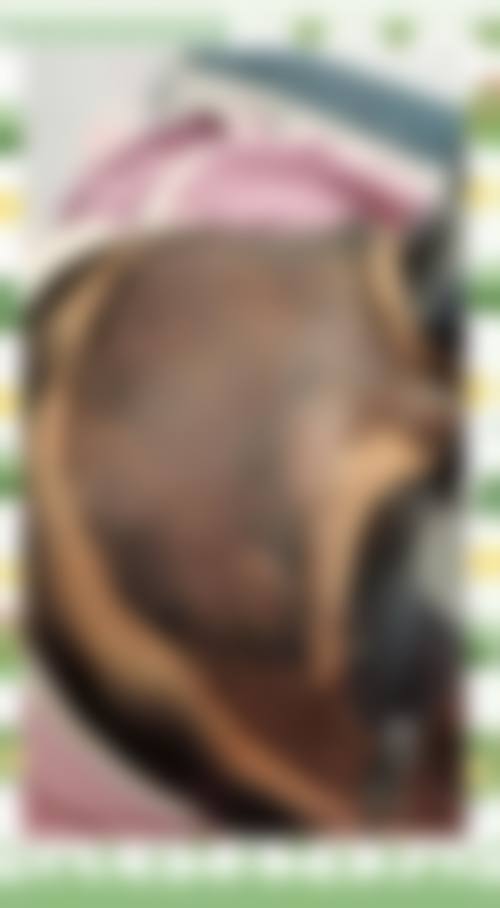 五、芜湖交通医院整形美容专科收费价格表