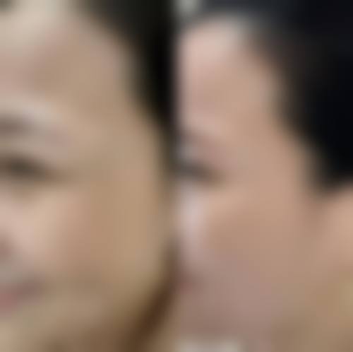 五、泉州丰泽维密医疗美容门诊部收费价格表