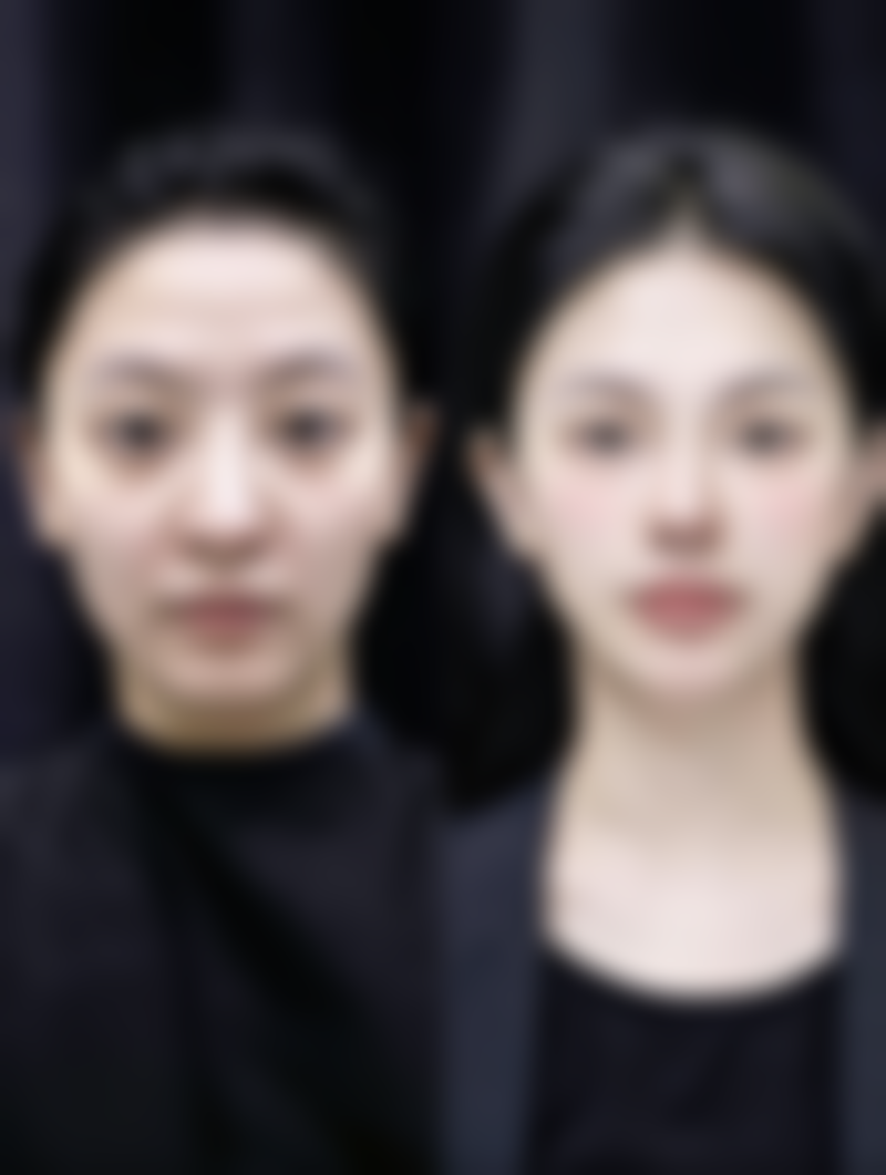 五、天津珍妮医疗美容门诊收费价格表