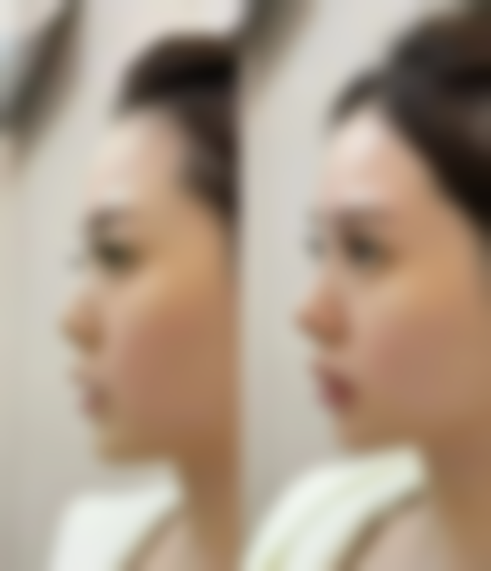 八、天津珍妮医疗美容门诊怎么预约？