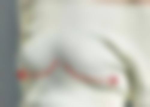 五、驻马店广济医院医疗美容韩金峰医生技术怎么样？