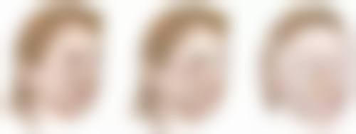 苹果肌的特点与作用