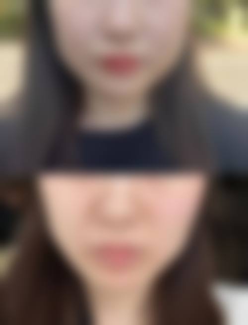 八、乌鲁木齐美呈医疗美容门诊部怎么预约？