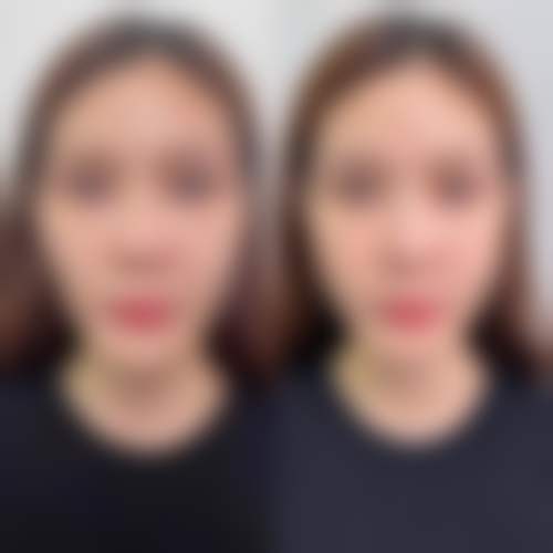 五、北京西美斯马永光医生技术怎么样?