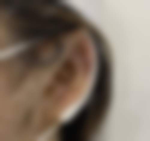 二、北京西美斯马永光医生擅长项目