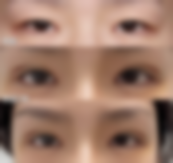 二、驻马店广济医院医疗美容韩金峰医生擅长项目