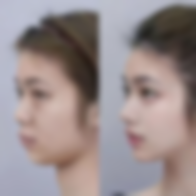 七、驻马店广济医院医疗美容韩金峰医生怎么预约？