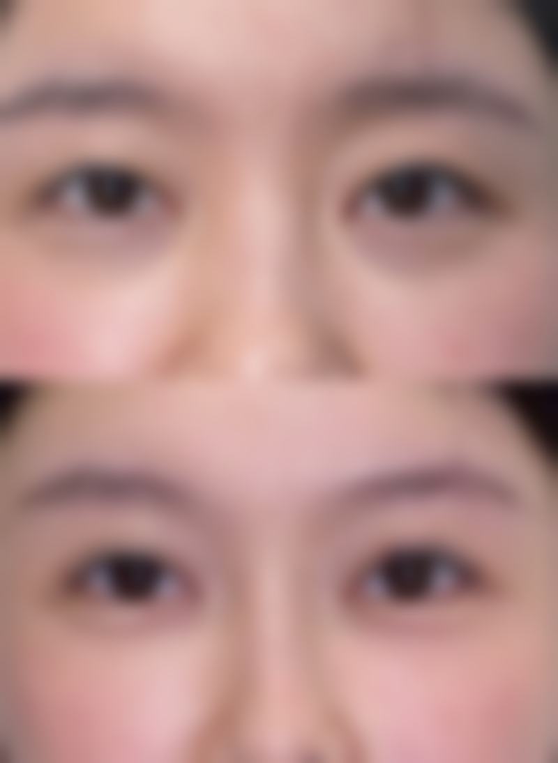 五、朴二铉医生技术怎么样？